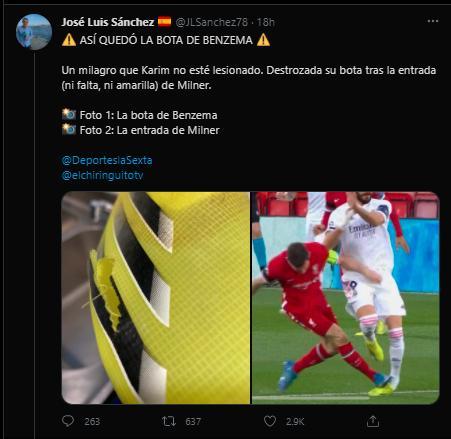 胆小慎入！记者晒本泽马被米尔纳踩踏后的鞋子