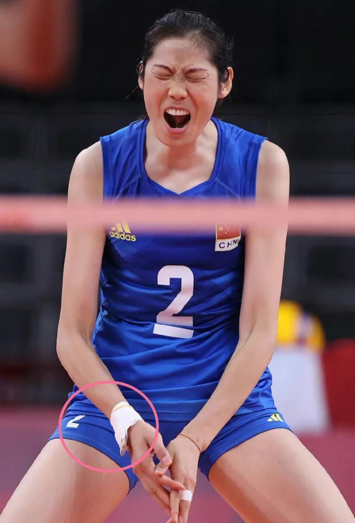 赛季报销，朱婷下赛季合同怎么办？郎平该站出来，排协该拿出态度